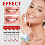 Yayashi SP6 Whitening Toothpaste 120g– Removes Stains from Coffee, Tea & Smoking